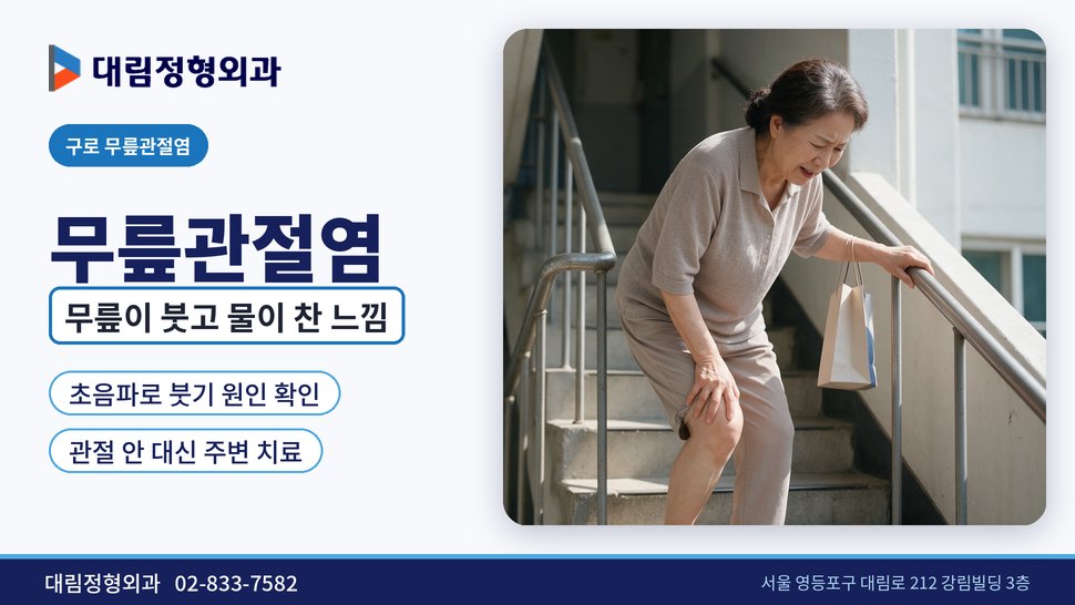 구로 무릎관절염 정형외과, 무릎이 붓고 물이 찬 느낌일 때